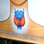 Are You Thyroid-Aware?